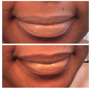 lip 1