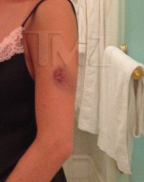 lydia-nam-the-dream-pregnant-injury-photos-017-480w