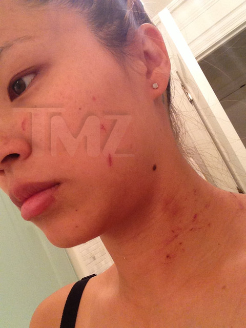 lydia-nam-the-dream-pregnant-injury-photos-03-480w