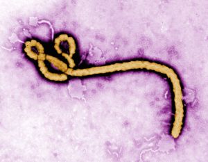 ebola virus.kallista images.getty
