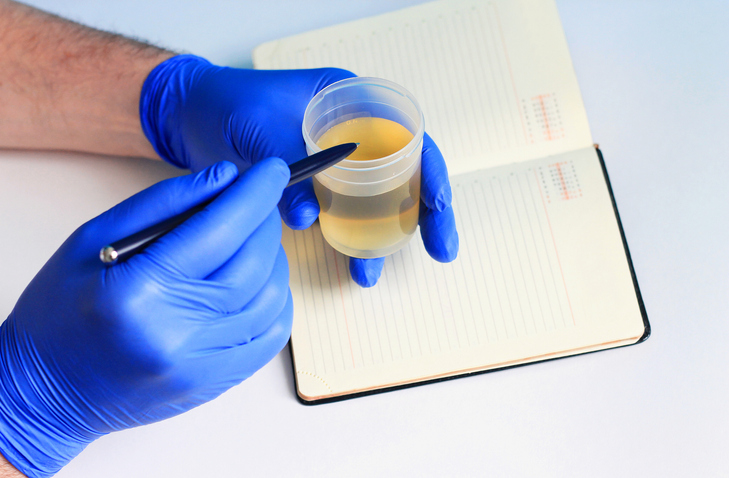 urine in a test jar in hand on a white background