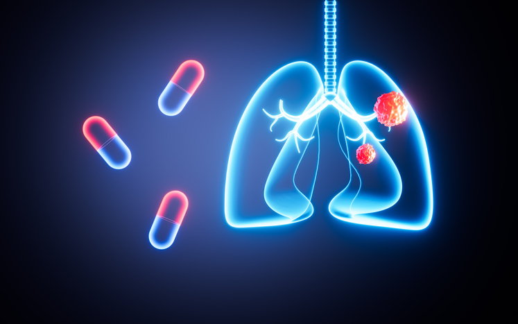 Drug treatment of lung disease, lung treatment, lung cancer, 3d rendering.